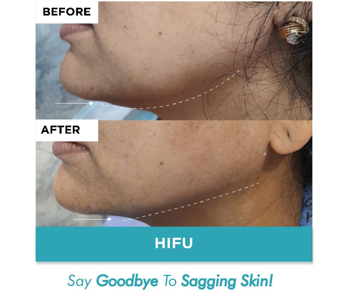 Dịch vụ chụp ảnh spa tại TPHCM